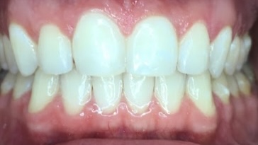 smile gallery image