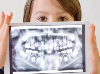 Dental X-Rays: 7 of Your Top Questions, Answered!