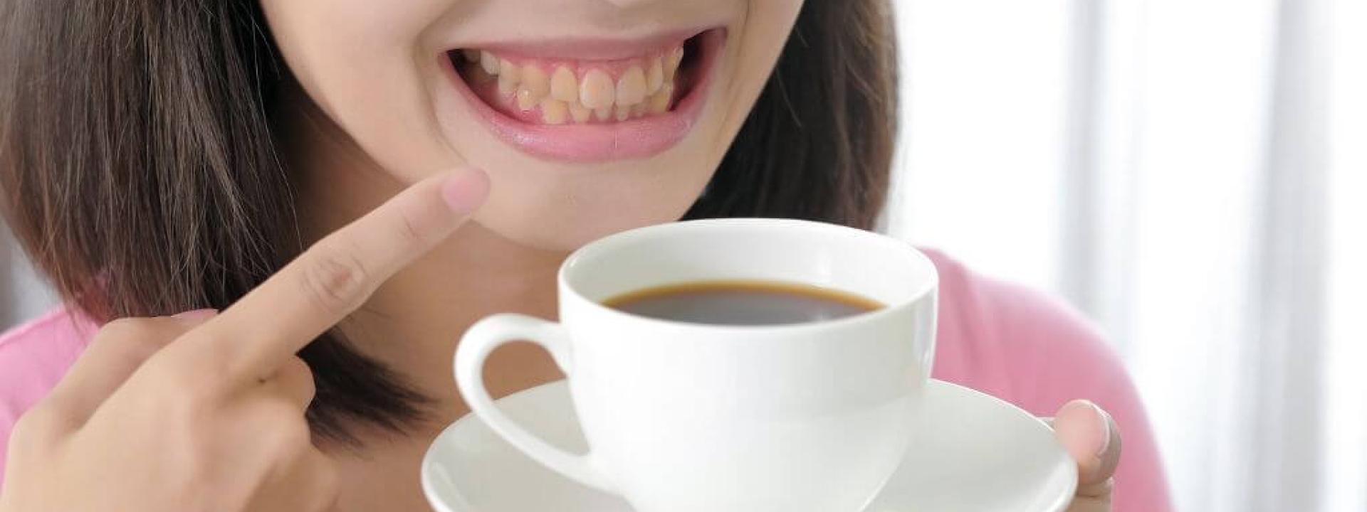 Common Causes of Tooth Discoloration