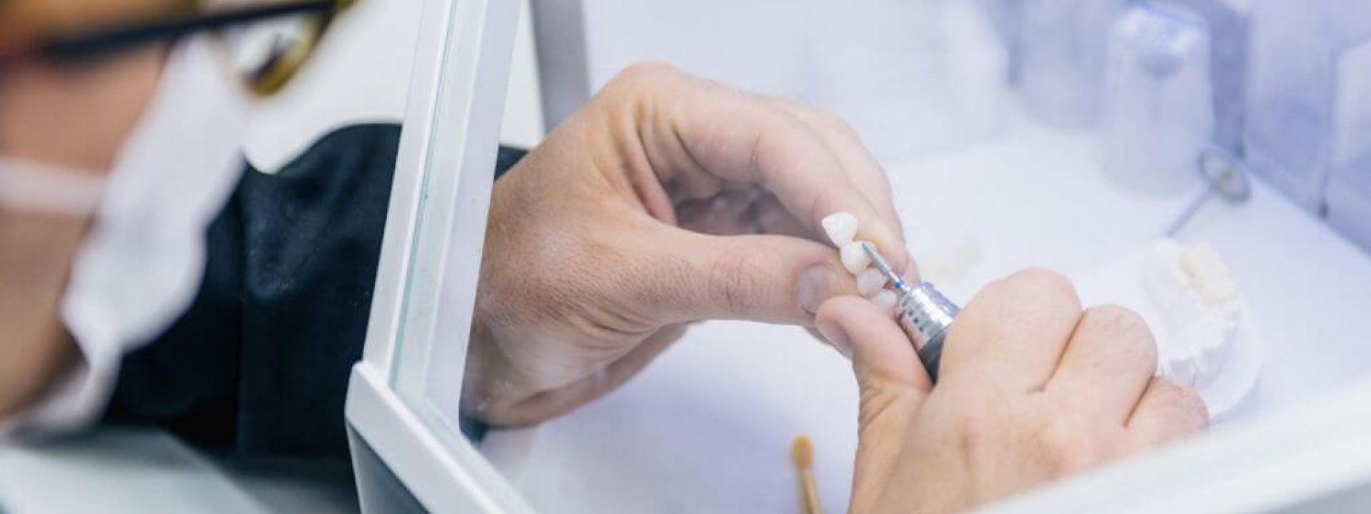 From Cavities to Missing Teeth