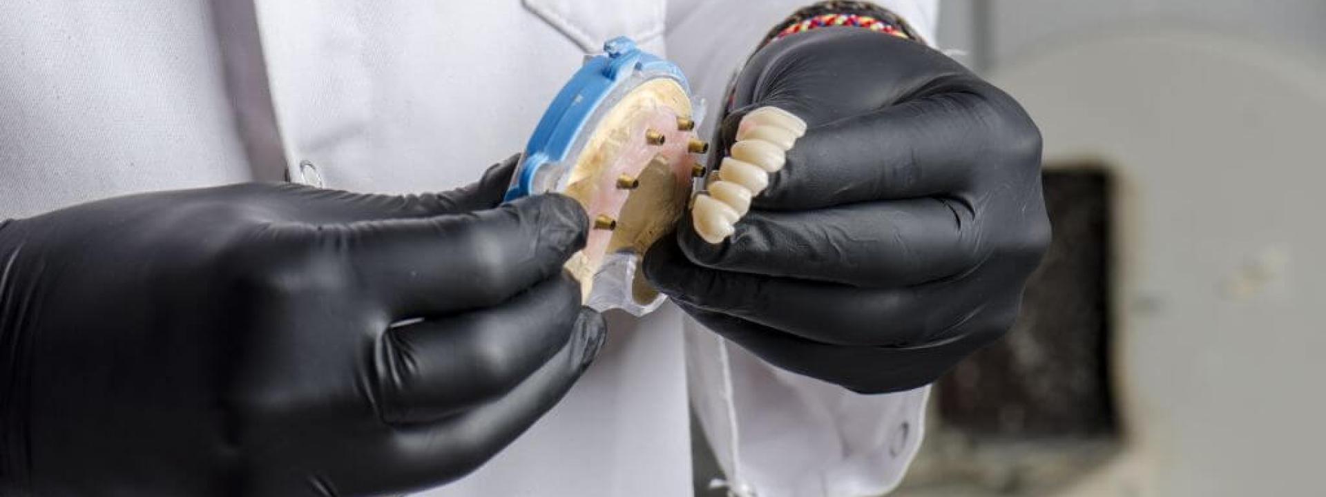 Implant-Supported Dentures